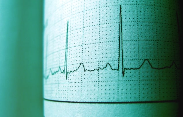 Electrocardiogram