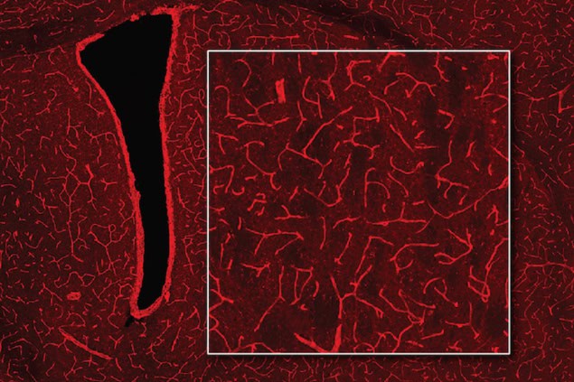 An image of blood vessels in the brain resembling a complex embroidery of bright-red threads on a black background